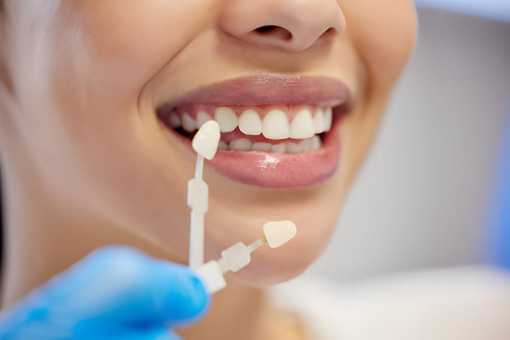 cosmetic veneers near you