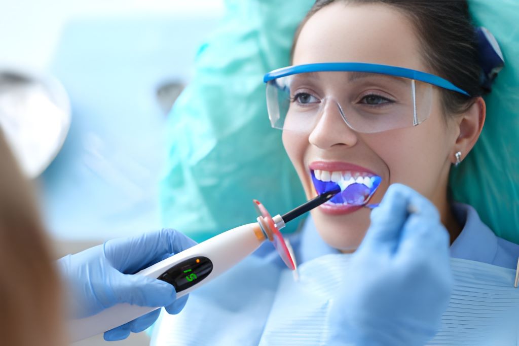 dental bonding in londonderry