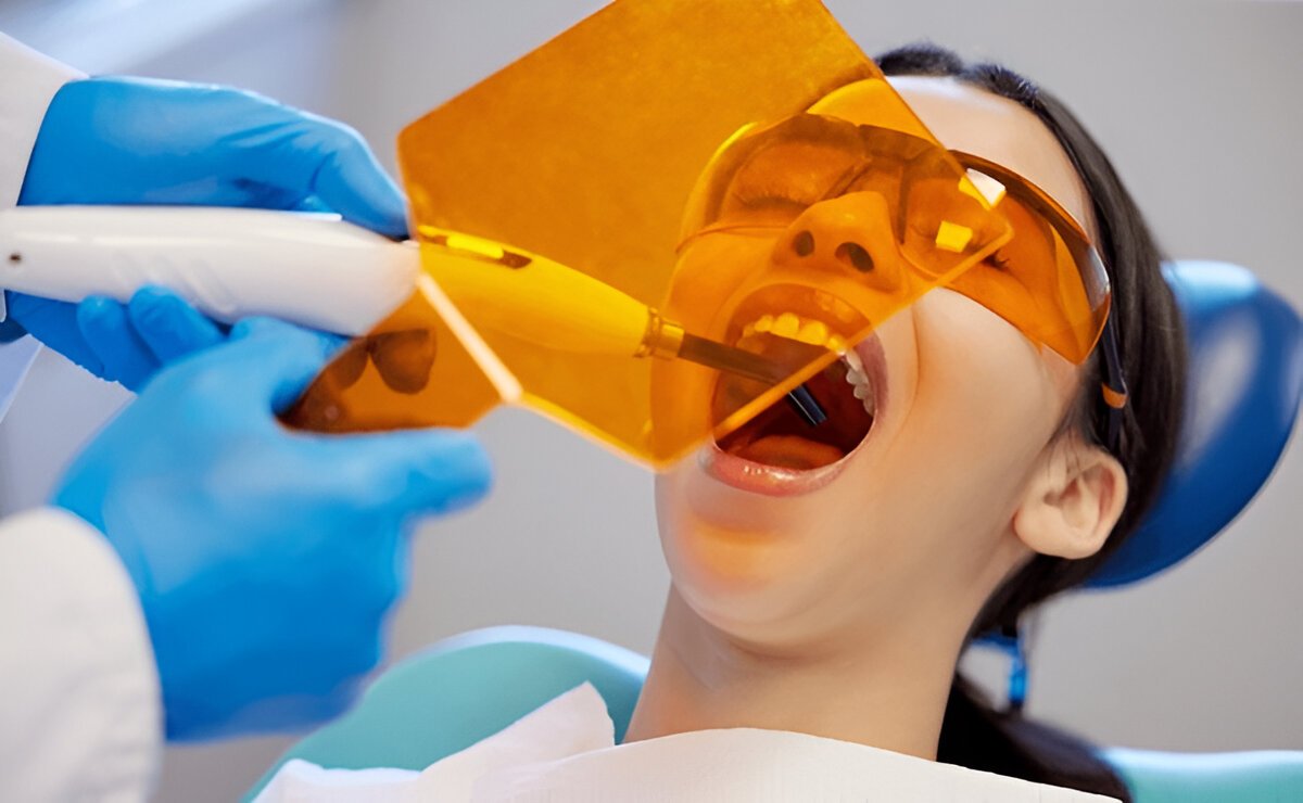 dental fillings in londonderry​