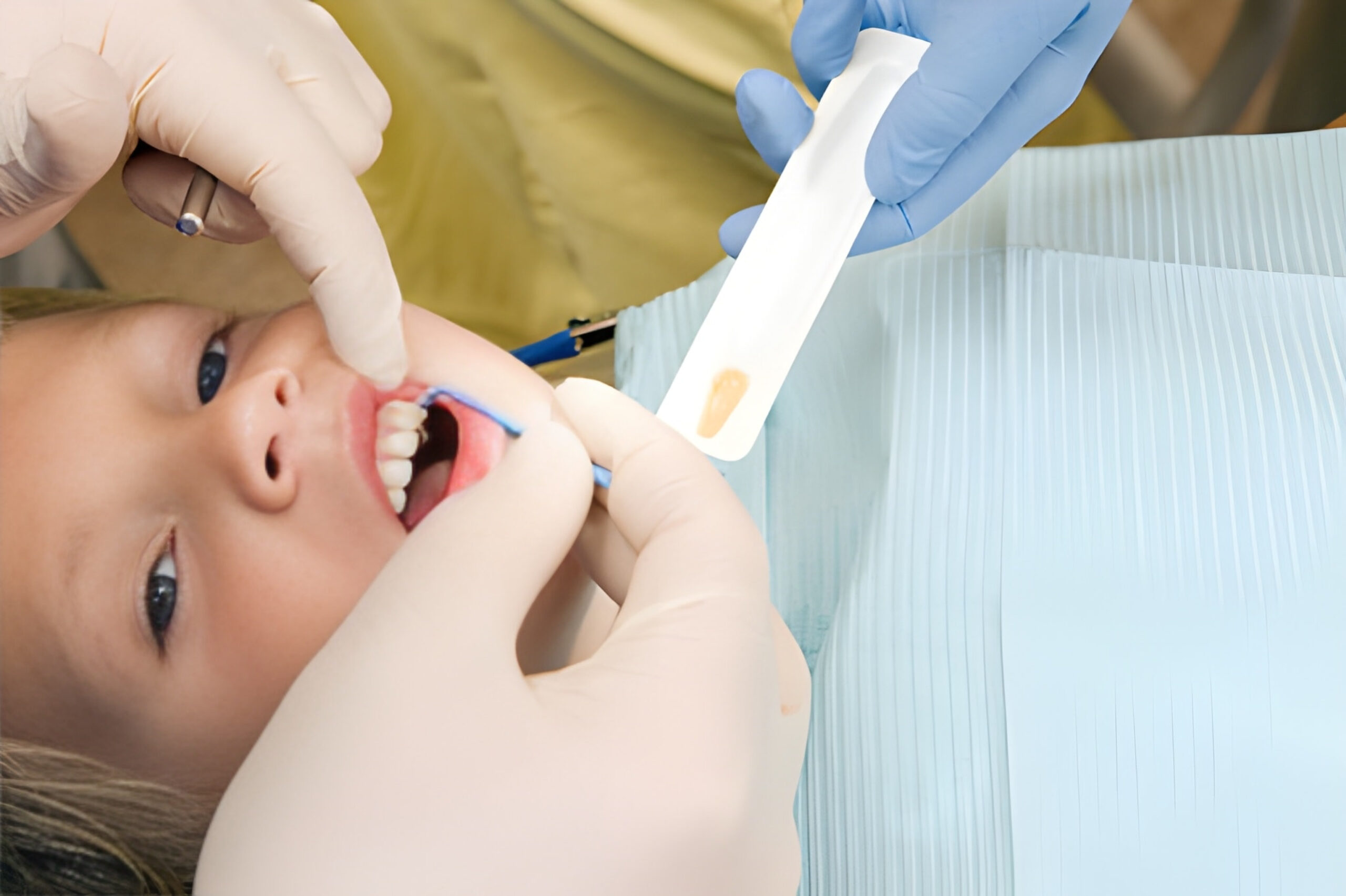 fluoride treatment near you
