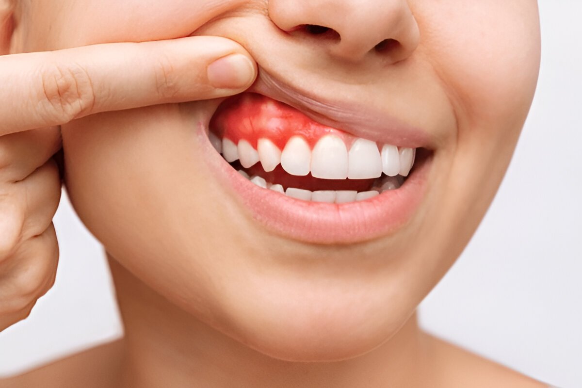 periodontal disease treatment in londonderry