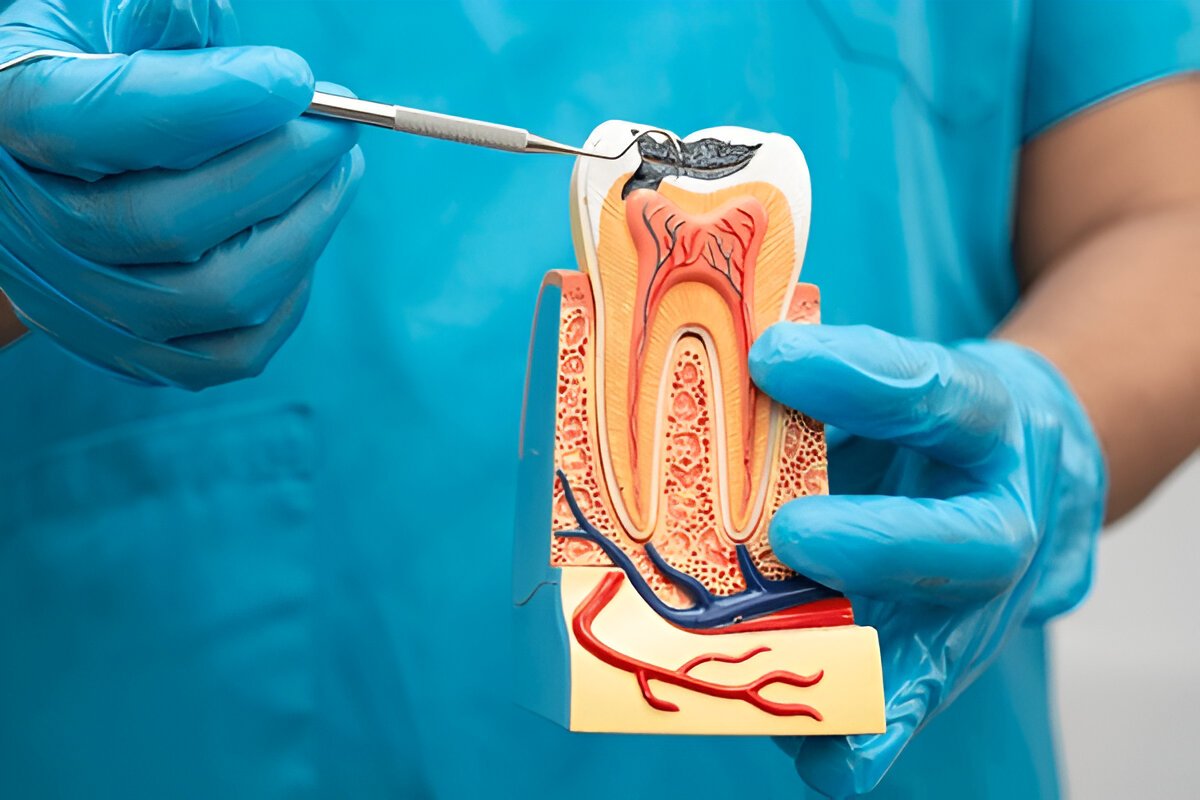 root canal treatment near you