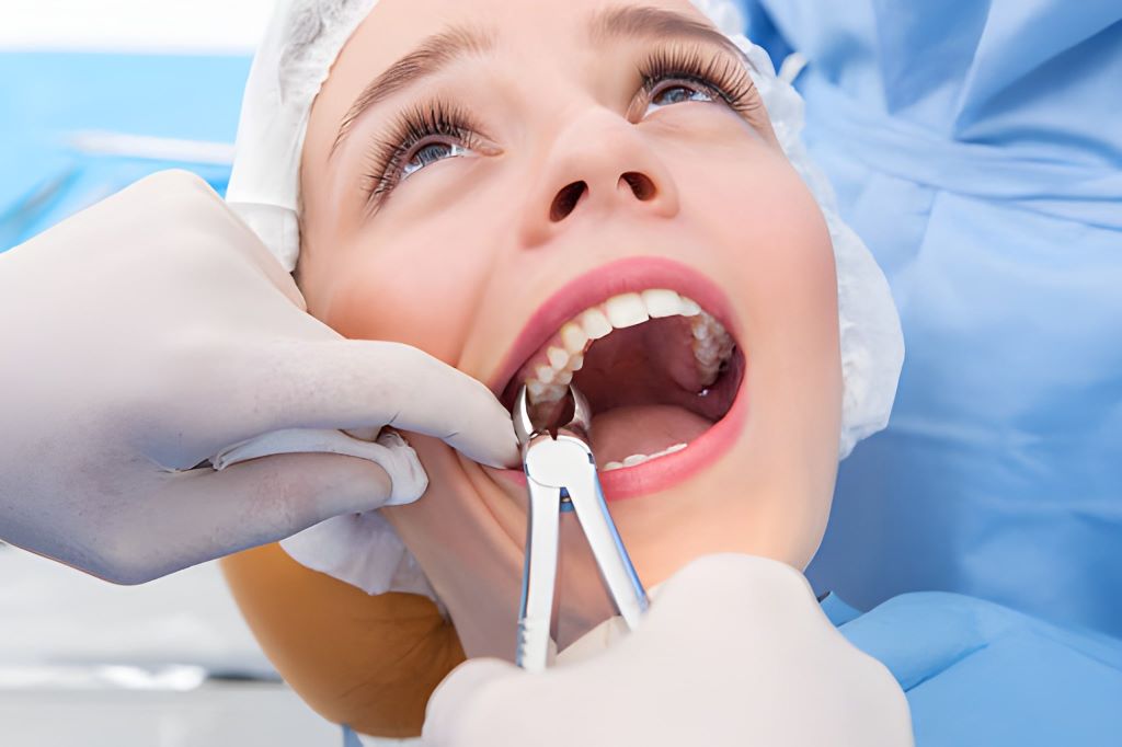 tooth extractions near you