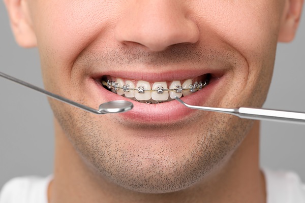 orthodontics in londonderry