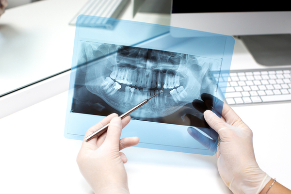 step-by-step guide to a digital dental x-ray exam